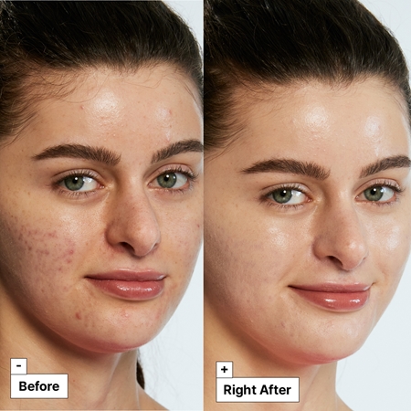 Dr. Jart+ Cicapair™ Tiger Grass Color Correcting Treatment Crema intensiva impotriva inrosirii pielii.