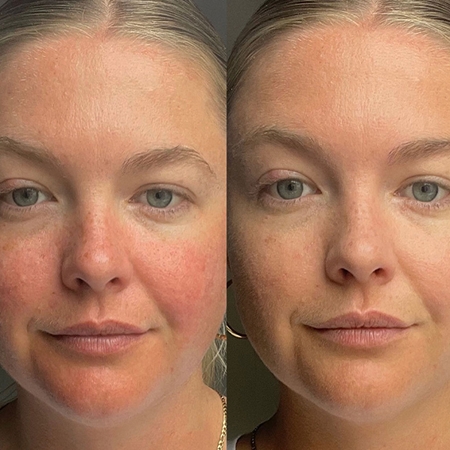 Dr. Jart+ Cicapair™ Tiger Grass Camo Drops SPF 35 gyengéd tonizáló fluid