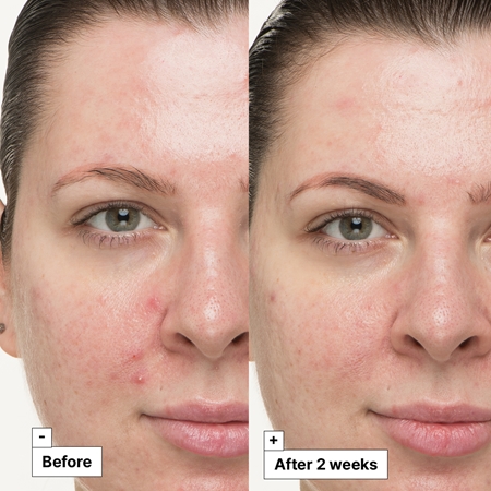 Dr. Jart+ Cicapair™ So Soothing Treatment tratamento local neutralização da vermelhidão