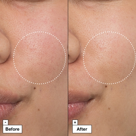 Dr. Jart+ Cicapair™ Intensive Soothing Repair Cream creme intensivo para reduzir a vermelhidão da pele