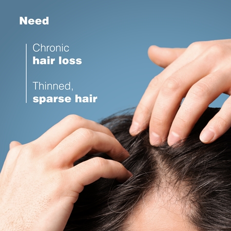 Ducray Anaphase+ Anti-Hair Loss Anti-Thinning Shampoo Tugevdav ja elavdav šampoon juuste väljalangemise raviks