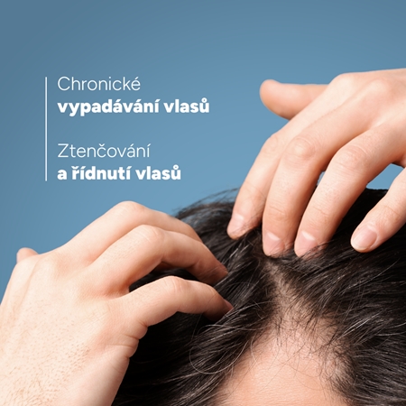 Ducray Anaphase+ Anti-Hair Loss Anti-Thinning Shampoo posilující a revitalizující šampon proti padání vlasů