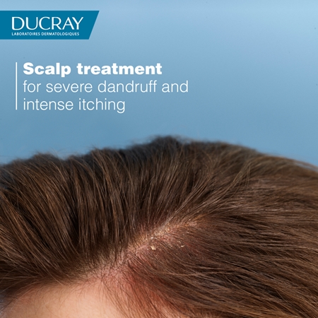 Ducray Kelual DS Treatment Shampoo nourishing shampoo for dandruff