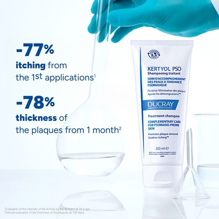 Ducray Kertyol P.S.O. Shampoo for dandruff
