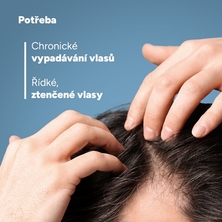 Ducray Neoptide Expert cílená péče proti vypadávání vlasů pro růst vlasů a posílení od kořínků