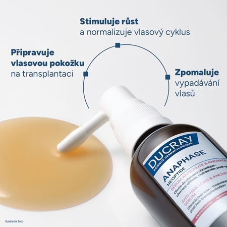 Ducray Neoptide Expert cílená péče proti vypadávání vlasů pro růst vlasů a posílení od kořínků