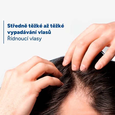 Ducray Neoptide Expert cílená péče proti vypadávání vlasů pro růst vlasů a posílení od kořínků