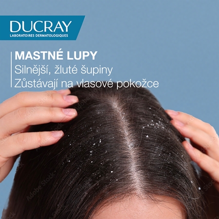 Ducray Kelual Squanorm Regulating Treatment Shampoo Oily Dandruff šampon proti mastným lupům