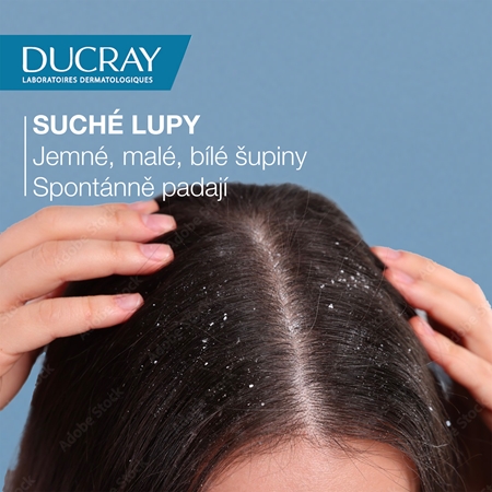 Ducray Squanorm šampon proti suchým lupům