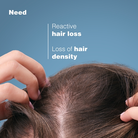 Ducray Anaphase+ Strenghthening Conditioner Styrkende balsam Til at behandle hårskørhed