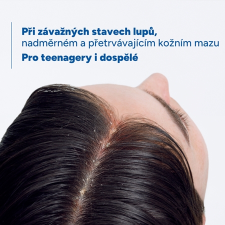 Ducray Kelual DS Sebocontrol šampon proti lupům