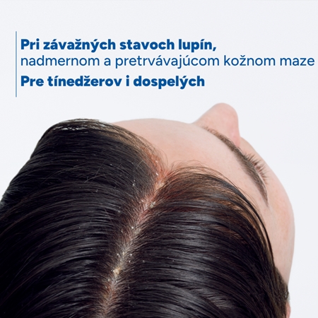 Ducray Kelual DS Sebocontrol šampón proti lupinám