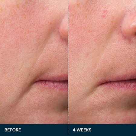 Elemis Pro-Collagen Future Restore Serum zpevňující sérum pro rozjasnění pleti