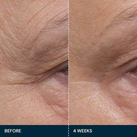 Elemis Pro-Collagen Future Restore Serum zpevňující sérum pro rozjasnění pleti