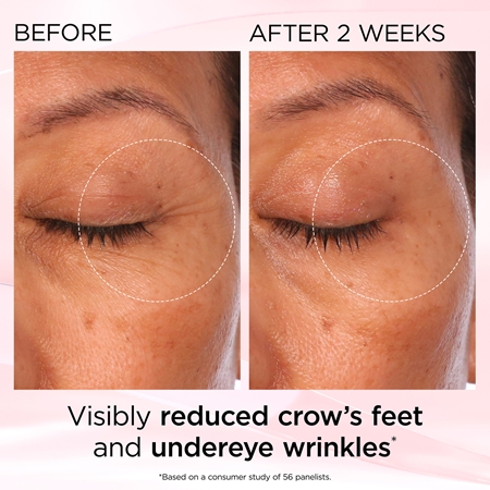 Elizabeth Arden Retinol + HPR Ceramide RAPID SKIN RENEWING EYE CREAM crème rajeunissante et illuminatrice yeux