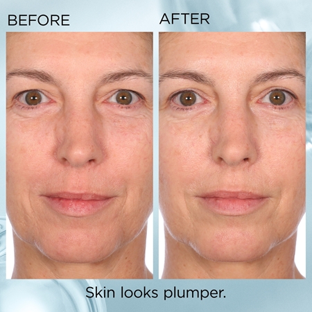 Elizabeth Arden Ceramide Hyaluronic Acid + Peptides kasvoseerumi kapseleina s ceramidy a peptidy