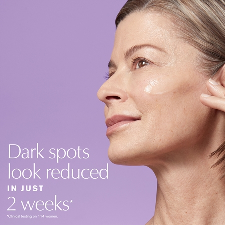 Estée Lauder Perfectionist Pro Rapid Brightening Treatment with Ferment³ + Vitamin C sérum illuminateur à la vitamine C anti-taches brunes