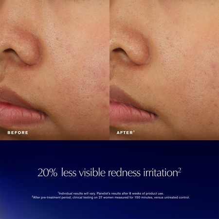 Estée Lauder Advanced Night Repair Recovery Treatment Essence hydratisierende Essenz zur Verjüngung der Gesichtshaut