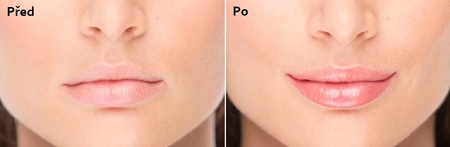 FacEvolution LipPlus Nourishing Lip Gloss with Lifting Effect