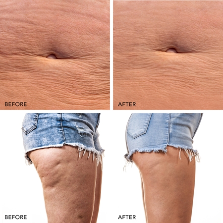 FOREO BEAR™ 2 body mikroproudový tonizační přístroj na tělo