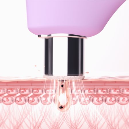 FOREO KIWI™ Derma aparelho de microdermoabrasão de diamante e limpeza dos poros