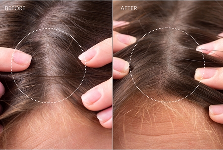 FOREO FAQ™ Scalp Recovery & Thick Hair Probiotic Serum probiotikus szérum a haj és a fejbőr regenerációjáért