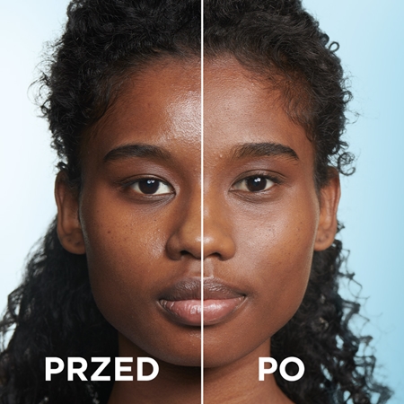 Garnier Pure Active nawilżający żel oczyszczający przeciw niedoskonałościom skóry