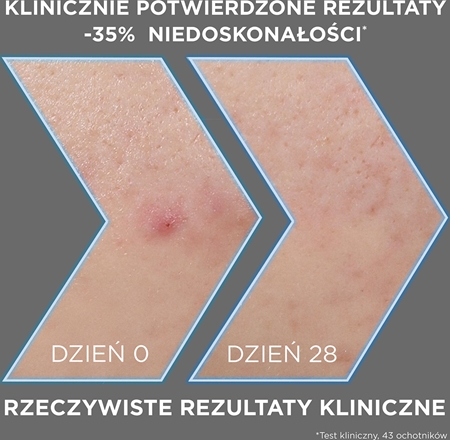 Garnier Pure Active Charcoal serum przeciw niedoskonałościom skóry