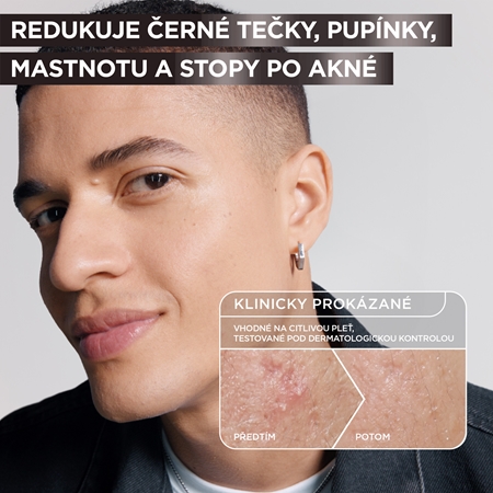 Garnier Pure Active Charcoal sérum proti nedokonalostem pleti