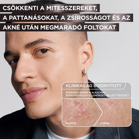 Garnier Pure Active Charcoal szérum a bőr tökéletlenségei ellen