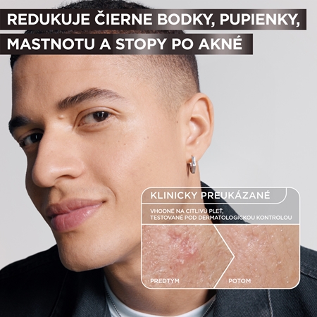 Garnier Pure Active Charcoal sérum proti nedokonalostiam pleti