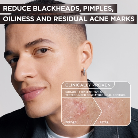 Garnier Pure Active Charcoal sérum anti-imperfections de la peau