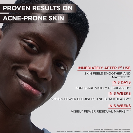 Garnier Pure Active Charcoal sérum anti-imperfections de la peau