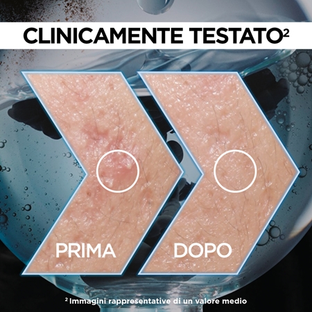Garnier Skin Active Pure Active siero contro le imperfezioni della pelle