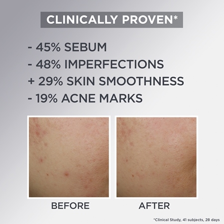 Garnier Skin Naturals Pure Active gel-creme leve para pele com imperfeições
