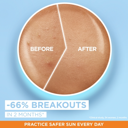 Garnier Ambre Solaire Super UV lozione protettiva ultra leggera contro le imperfezioni della pelle
