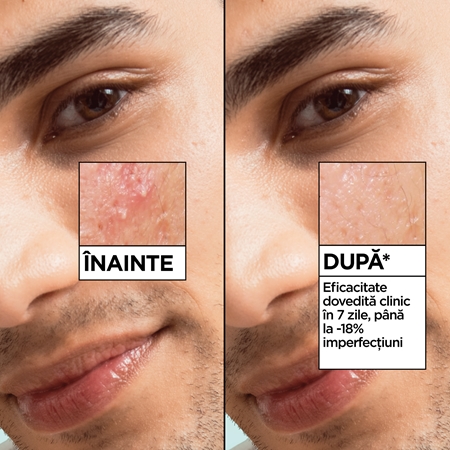 Garnier Salicylic Serum ser impotriva imperfectiunilor pielii