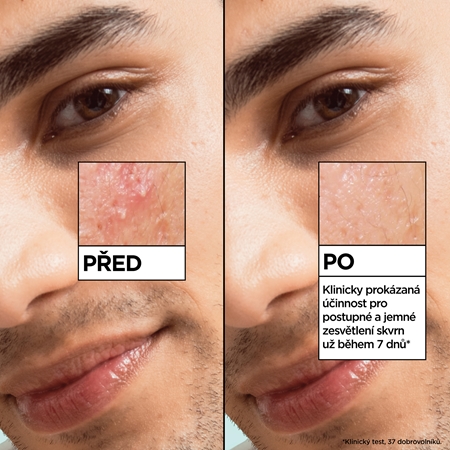 Garnier Salicylic Serum sérum proti nedokonalostem pleti