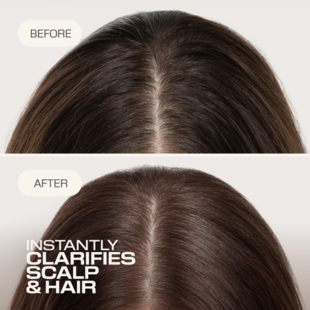 Goldwell Dualsenses Scalp Specialist Clarifying Shampoo shampoing nettoyant en profondeur
