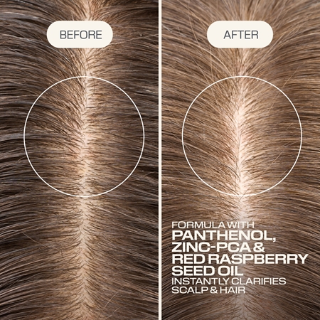 Goldwell Dualsenses Scalp Specialist Clarifying Shampoo shampoing nettoyant en profondeur
