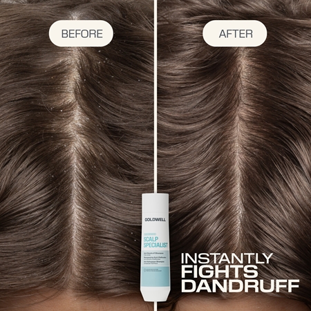 Goldwell Dualsenses Scalp Specialist Anti-Dandruff Shampoo Anti-Dandruff Shampoo