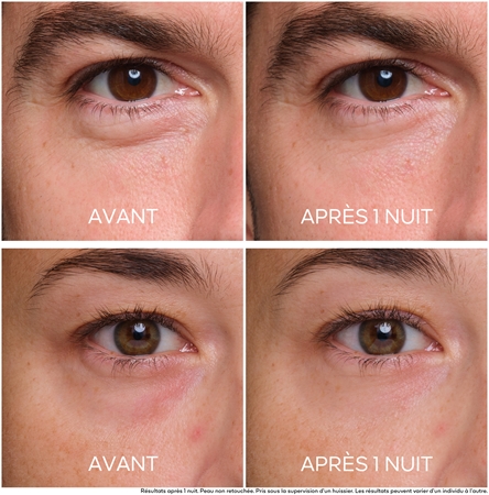 GUERLAIN Abeille Royale Midnight Secret soin yeux anti-rides, anti-enflures et anti-cernes