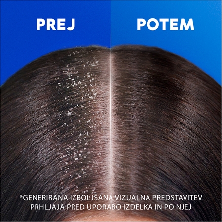 Head & Shoulders Extra Volume šampon proti prhljaju