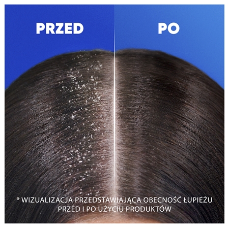 Head & Shoulders Citrus Fresh szampon przeciwłupieżowy