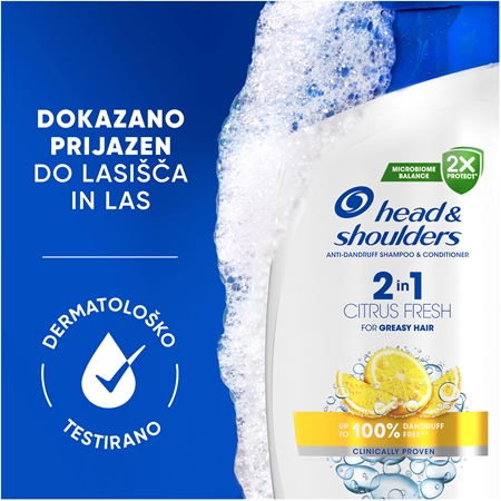 Head & Shoulders Citrus Fresh 2v1 šampon proti prhljaju za mastne lase