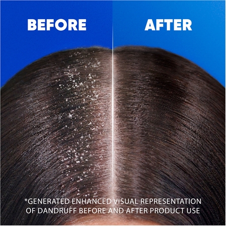 Head & Shoulders Citrus Fresh 2in1 Shampoo mit Conditioner gegen Schuppen