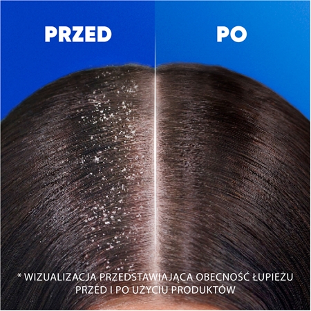 Head & Shoulders Smooth & Silky szampon przeciwłupieżowy 2 w 1