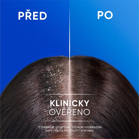 Head & Shoulders Menthol Fresh 2in1 šampon a kondicionér 2 v 1 proti lupům