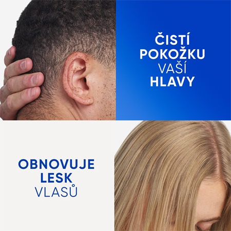Head & Shoulders Clarify&Shine Apple Cider šampon proti lupům
