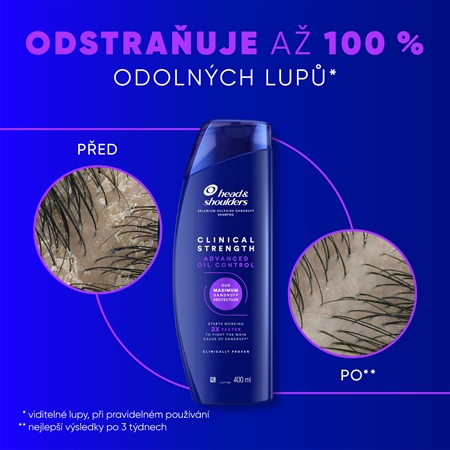 Head & Shoulders Advanced Oil Control šampon proti lupům